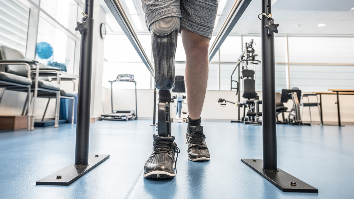 A person with a robotic artificial leg walking with the support of parallel bars