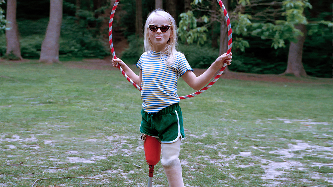 A child with prosthetic legs standing on two feet holding a hula hoop.