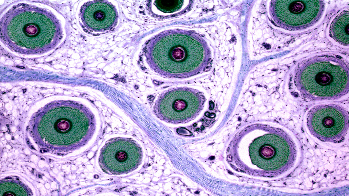 Small clear circles with an opaque pink center