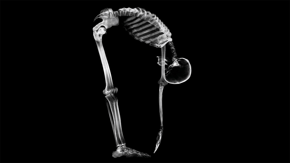 An x-ray of a human skeleton bending over to touch their toes. 