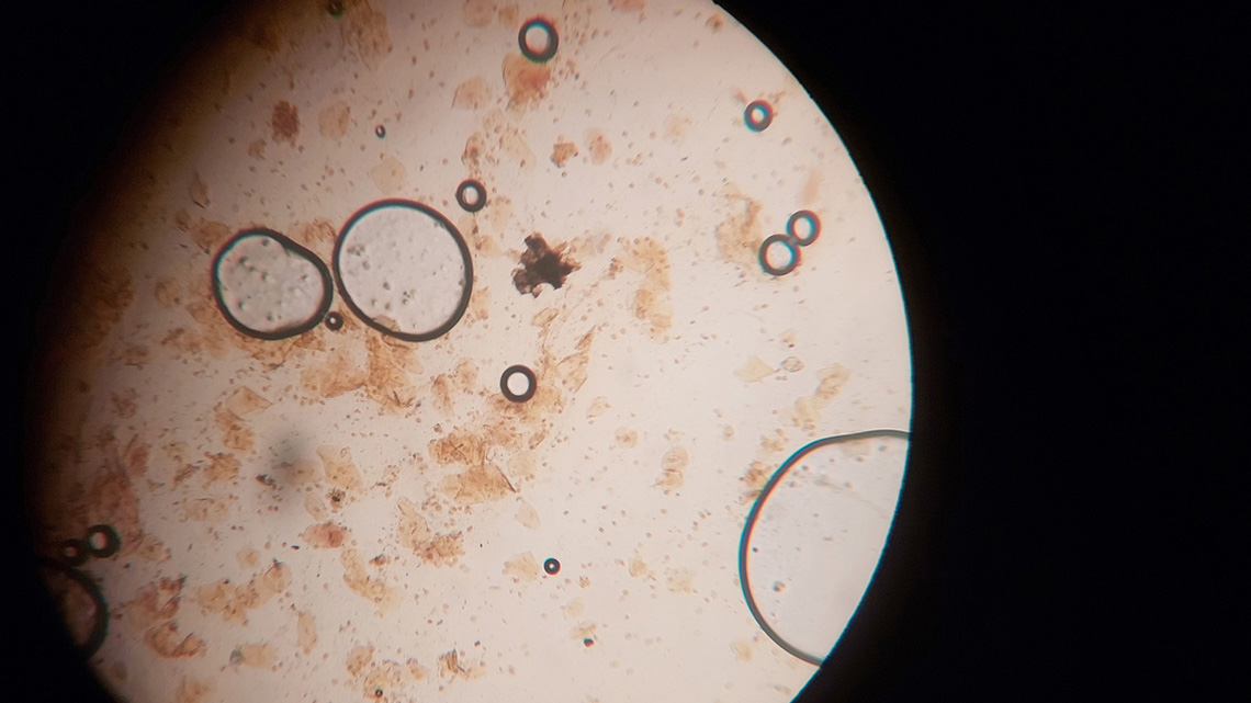 The bacteria from a cheek swab.