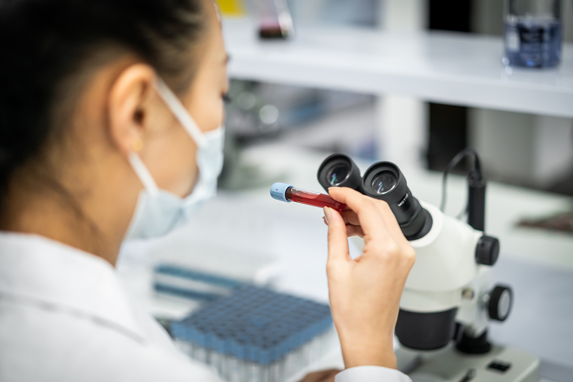 Microbiologist looks at a blood sample in a lab with a microscope in the background.