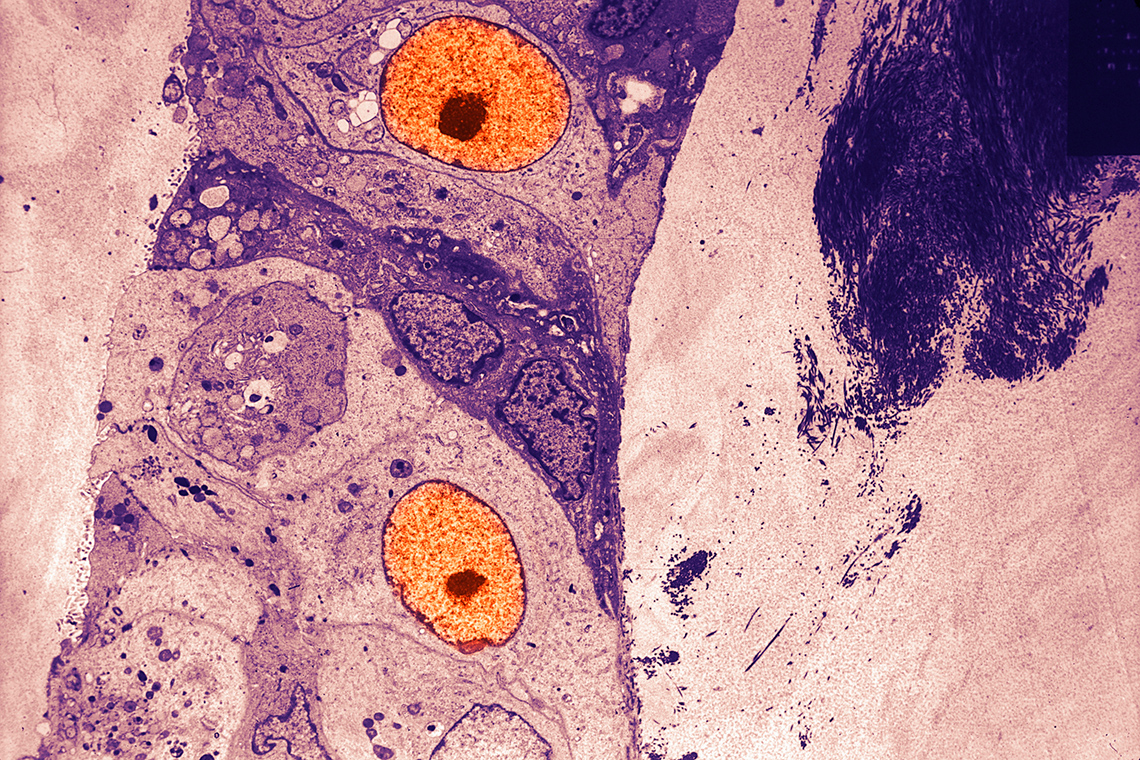 Dye-infused cells under a microscope.
