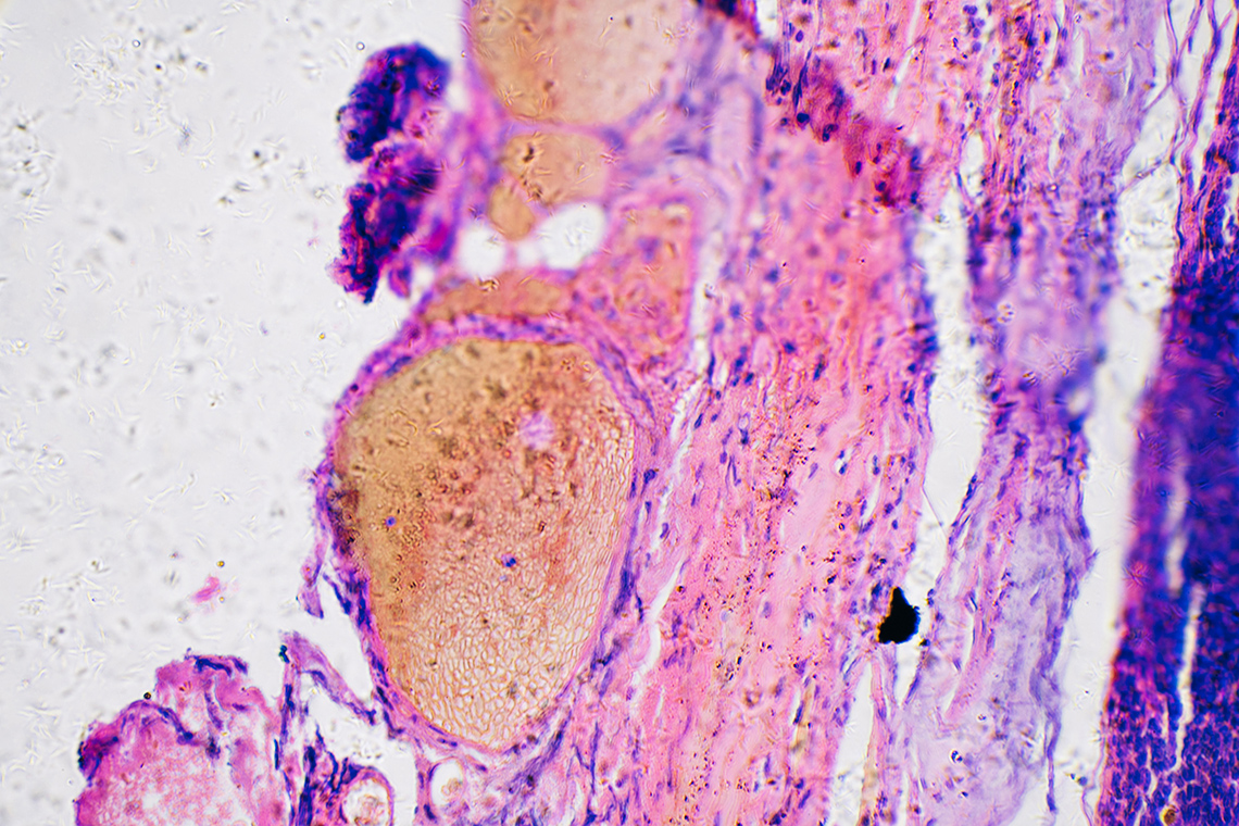 Dye-infused cells under a microscope.
