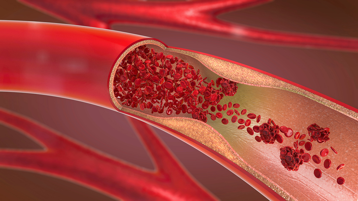 Blood cells flowing through a vein.