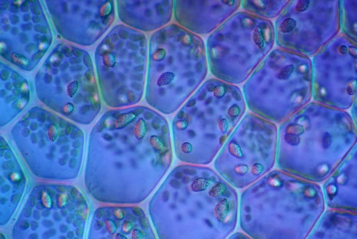 Cells under a microscope.