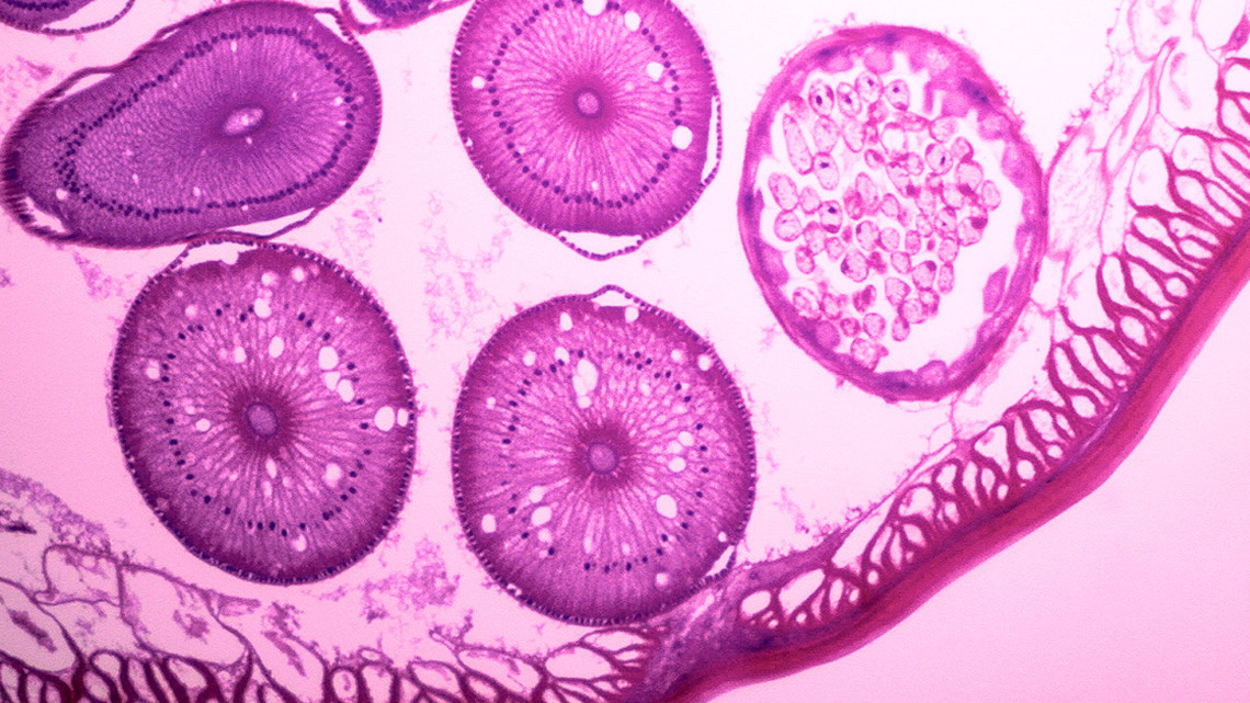 A cross-section of a worm under a microscope. There are several circular objects inside a thick wall membrane.